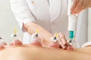 Hijama Therapy